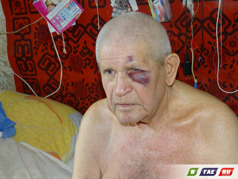 Бомжи избили и обокрали 86-летнего деда