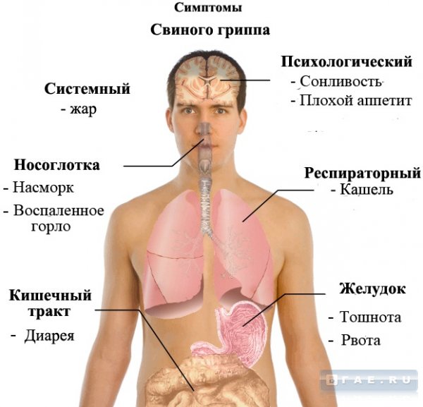 Свинной грипп
