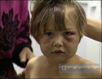 Жестокое обращение с детьми
