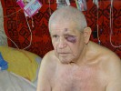 БОМЖи  избили и обокрали 86-летнего деда