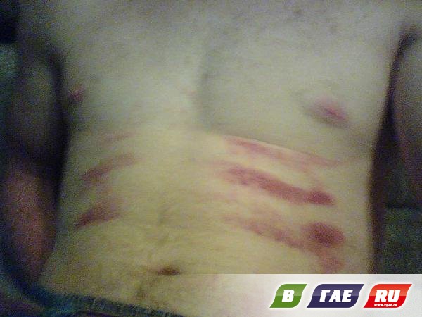 все травмы на правой стороне тела агентства