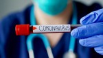 В Оренбужье зарегистрировано 157 случаев заражения коронавирусом