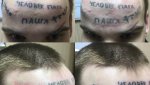 Гайчанин решил свести татуировки с лица